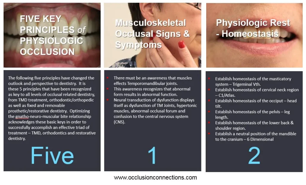Straight Teeth and Occlusion